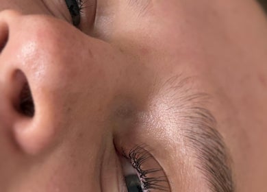 Close-up of radiant skin after treatment at Twin Flame Beauty Room, East Kilbride, Scotland, GB.