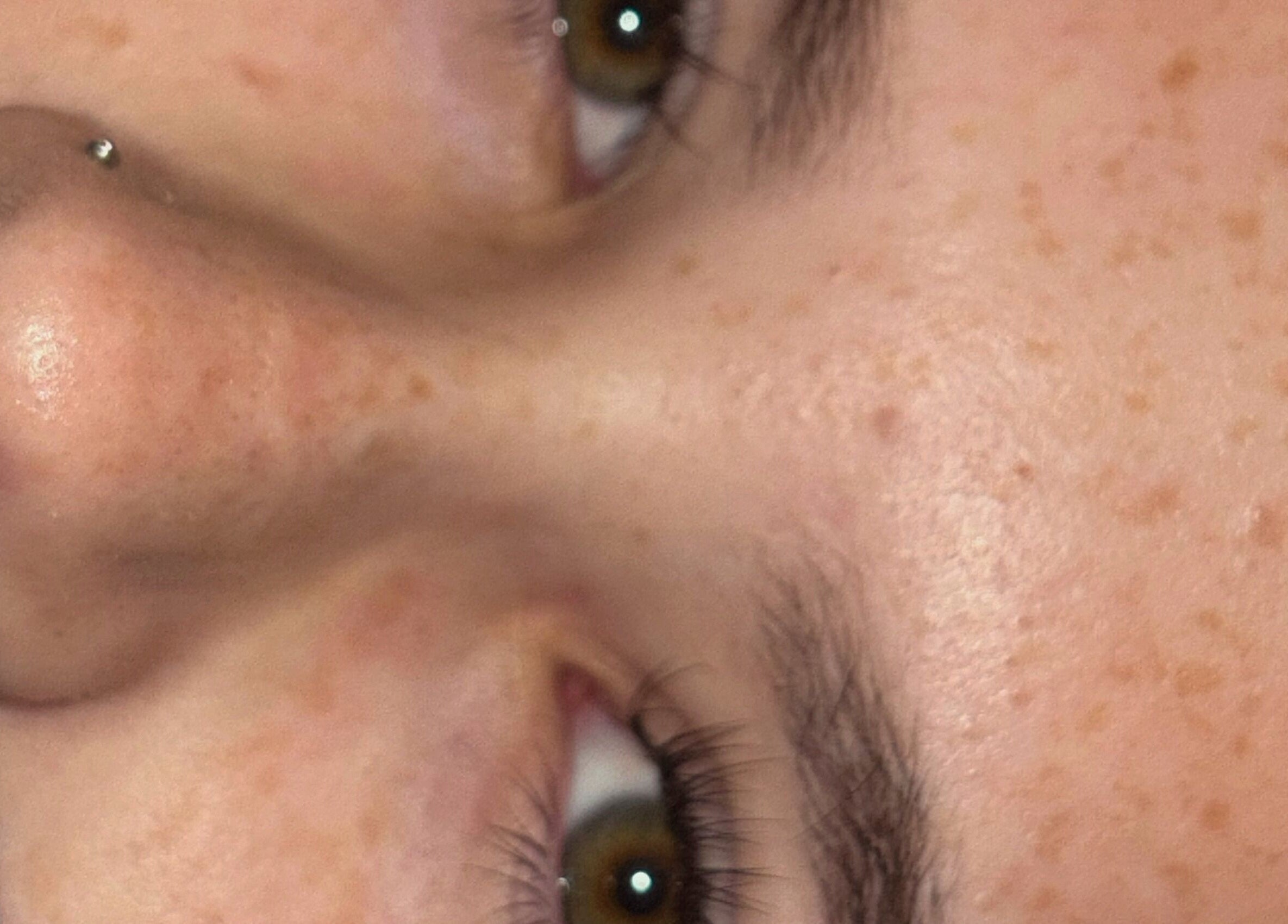 Close-up of radiant skin highlighting freckles at Twin Flame Beauty Room, East Kilbride, Scotland, GB.