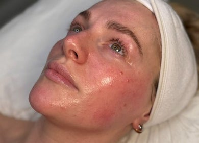 Client experiencing a revitalizing facial at NISHA SKNN Aesthetics & Skin, Liverpool, England, GB.