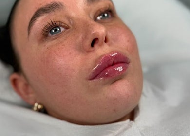 Close-up of a facial treatment at NISHA SKNN Aesthetics & Skin in Liverpool, England, GB with glowing skin.