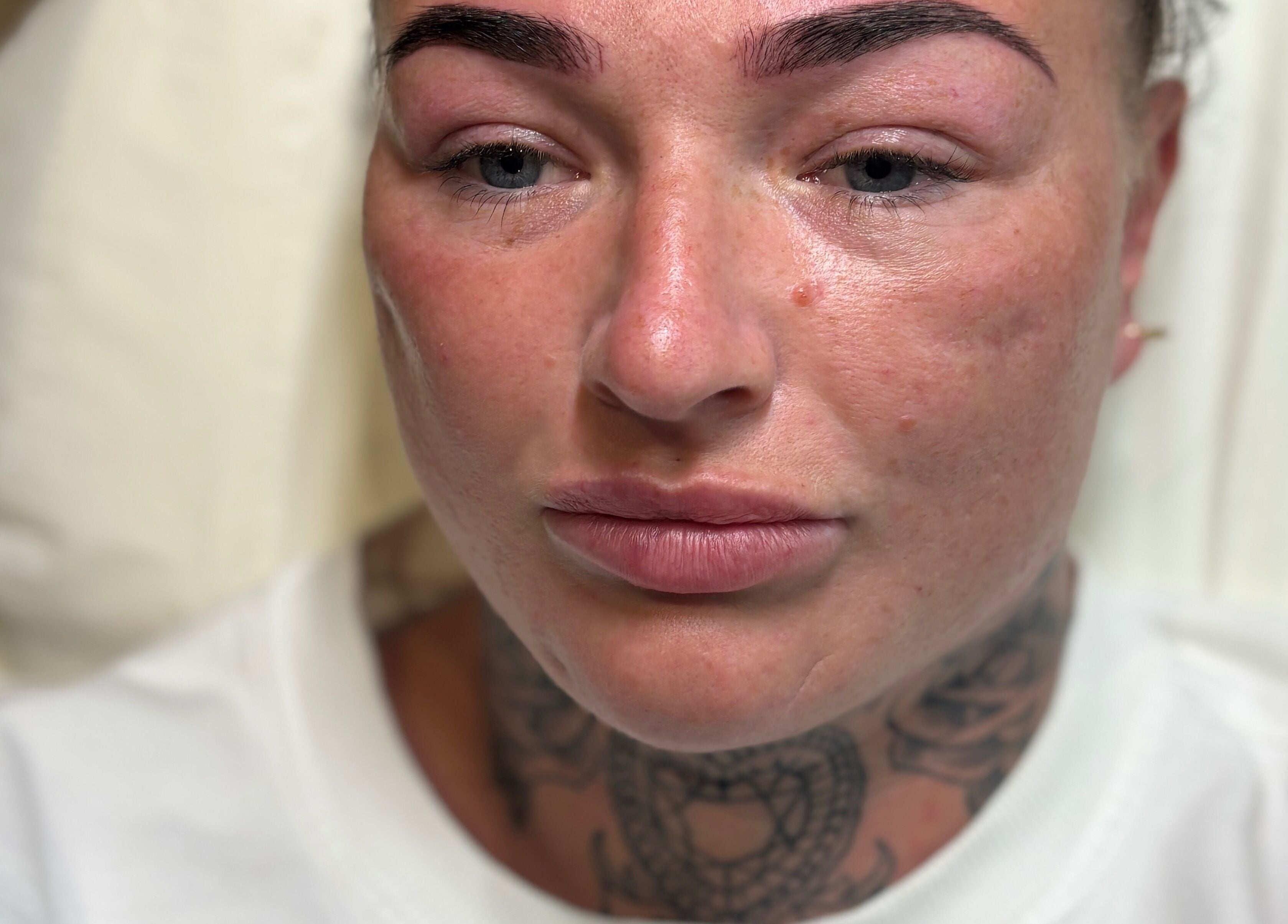 Close-up of a client's skin treatment results at Amber Rose Cosmetics, Wombourne, England, GB.