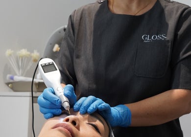 Skin treatment at Gloss Skin Boutique, Singapore, SG highlighting professional care and precision.