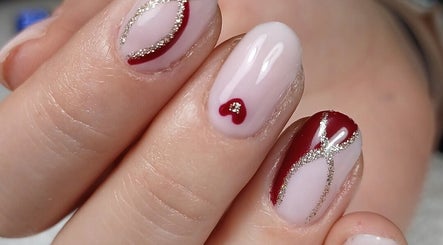 NH Onglesの画像：2