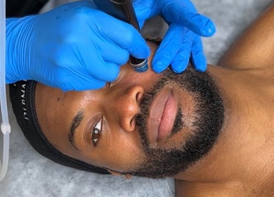 HydraFacial treatment at DermaBalance, Royal Tunbridge Wells, England, GB. Close-up of client receiving skincare.