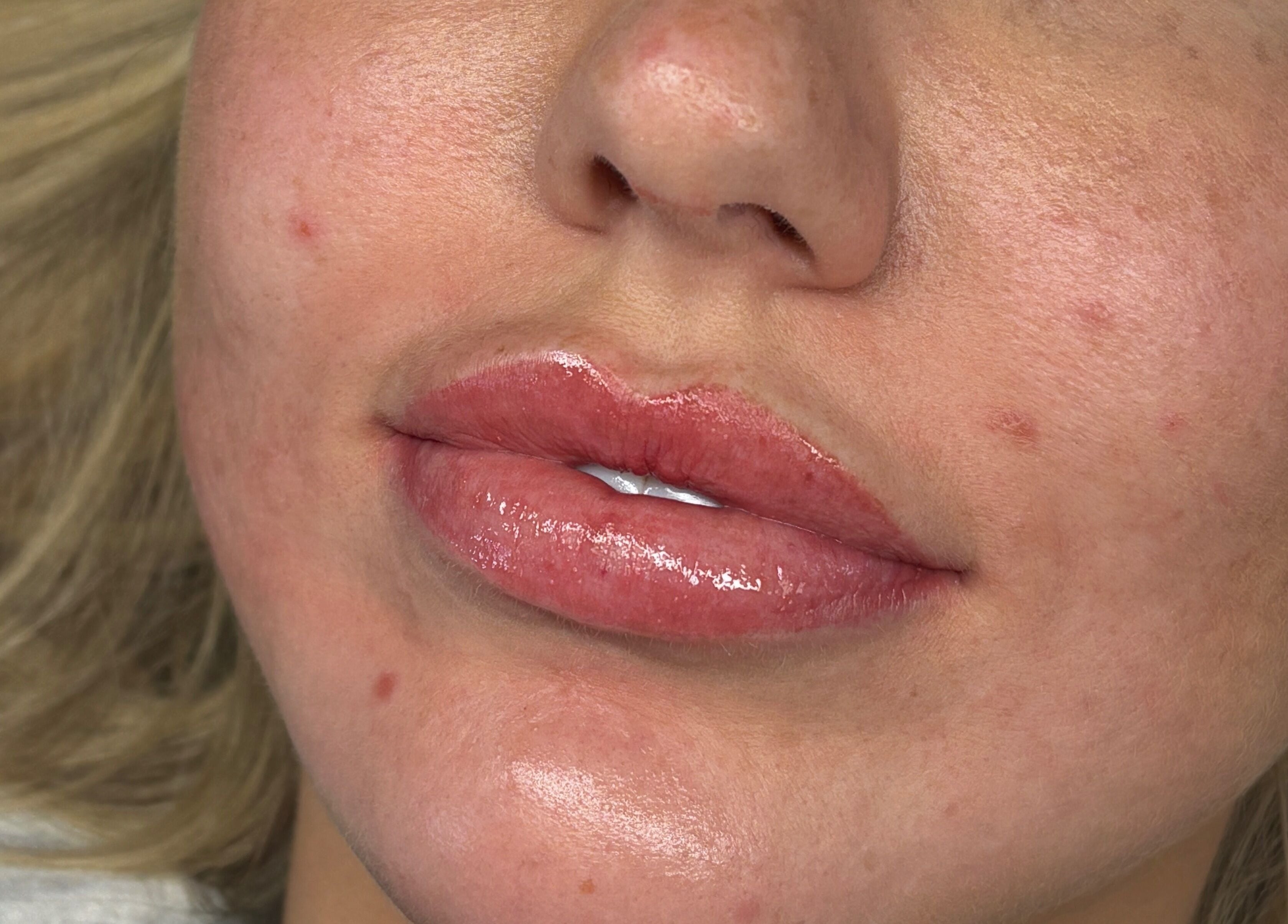 Close-up of glossy lips after treatment at Beauty by Imogen, Portsmouth, England, GB.
