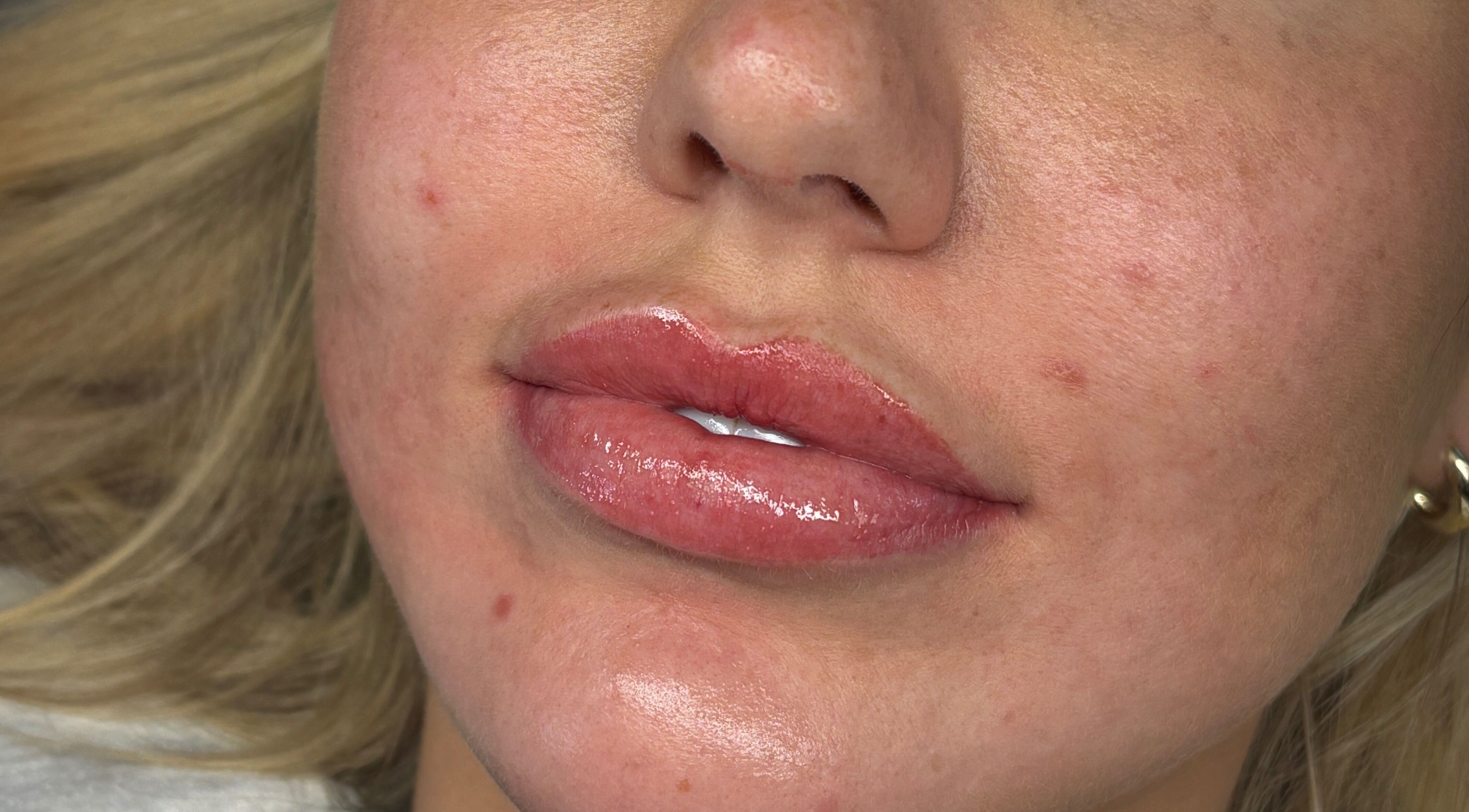 Close-up of glossy lips after treatment at Beauty by Imogen, Portsmouth, England, GB.
