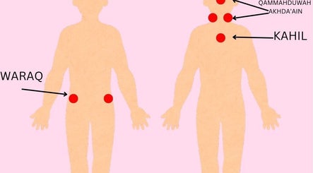 Blossom Cupping Therapy, bilde 3