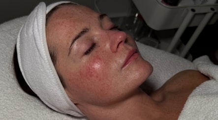 Laserandskinbyoliviagrant, bild 2