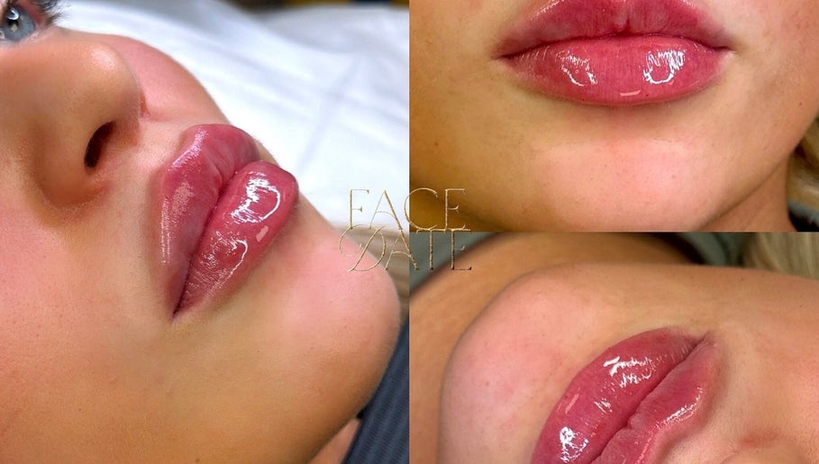 Three images of glossy lips at Facedate Studio in Whalley, England, GB showcasing expert beauty techniques.