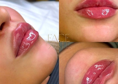 Three images of glossy lips at Facedate Studio in Whalley, England, GB showcasing expert beauty techniques.