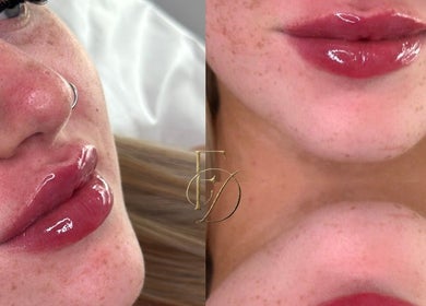 Close-up of glossy lips and freckled skin at Facedate Studio, Whalley, England, GB.