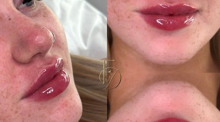 Close-up of glossy lips and freckled skin at Facedate Studio, Whalley, England, GB.