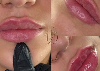 Close-up of glossy lips from Facedate Studio, Whalley, England, GB, showcasing beauty enhancement.