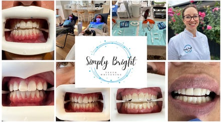 Simply Bright Teeth Whitening Gippsland image 2