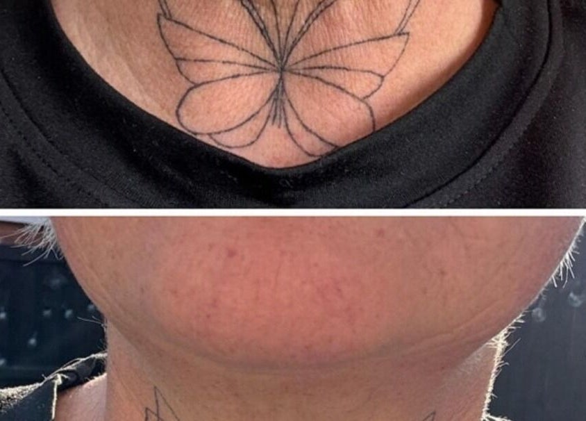 Butterfly tattoo on neck from Mobile in Home appointment, Kidsgrove, England, GB.