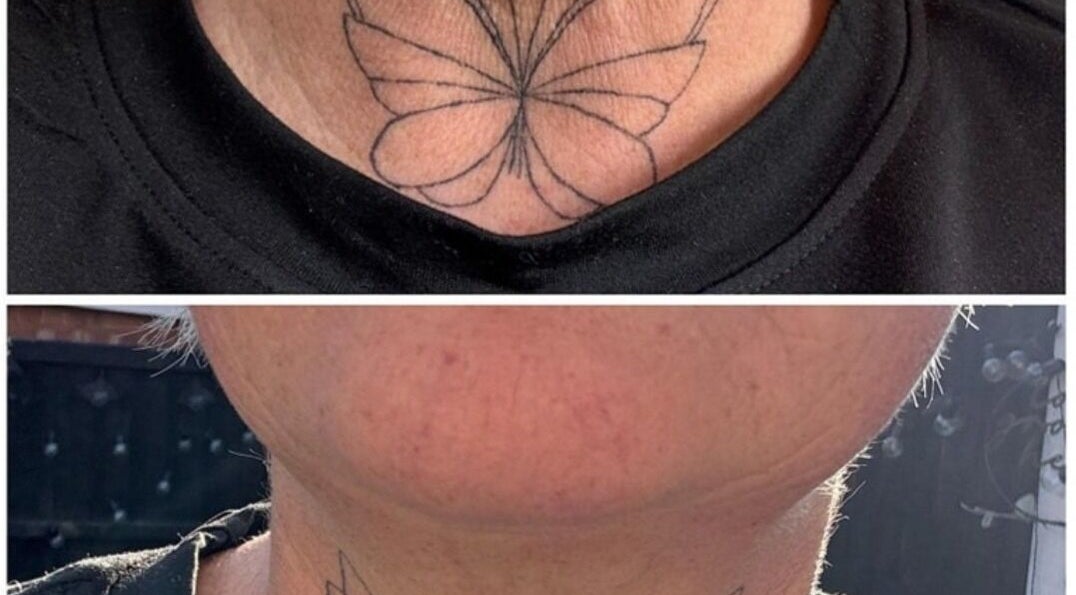 Butterfly tattoo on neck from Mobile in Home appointment, Kidsgrove, England, GB.