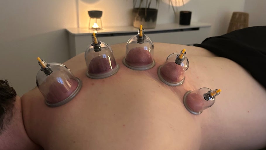 Cupping therapy session at PL Massage Therapy - Mobile Therapist, Mansfield, England, GB.