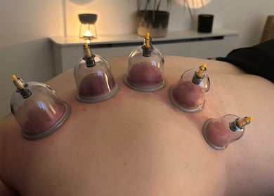 Cupping therapy session at PL Massage Therapy - Mobile Therapist, Mansfield, England, GB.