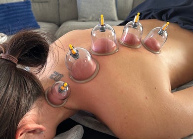 Cupping therapy session at PL Massage Therapy - Mobile Therapist in Mansfield, England, GB.