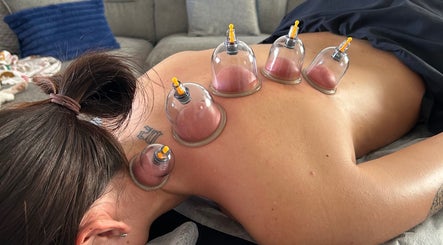Cupping therapy session at PL Massage Therapy - Mobile Therapist in Mansfield, England, GB.