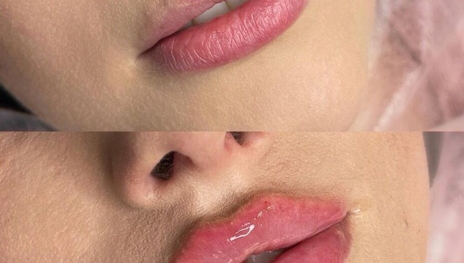 NOVA BEAUTY CLINIC – kuva 1