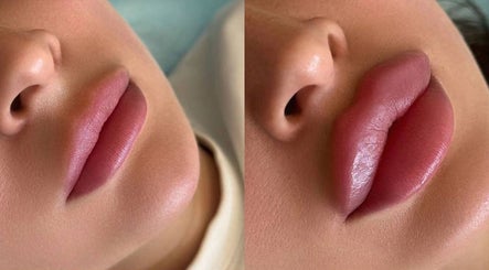 NOVA BEAUTY CLINIC – kuva 2