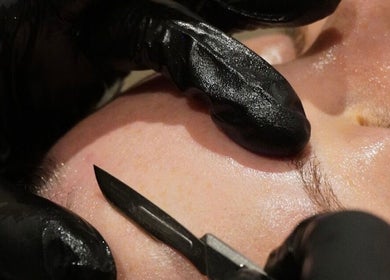 Close-up dermaplaning treatment at Cortés & Co Medispa, Usk, Wales, GB enhancing smooth skin.