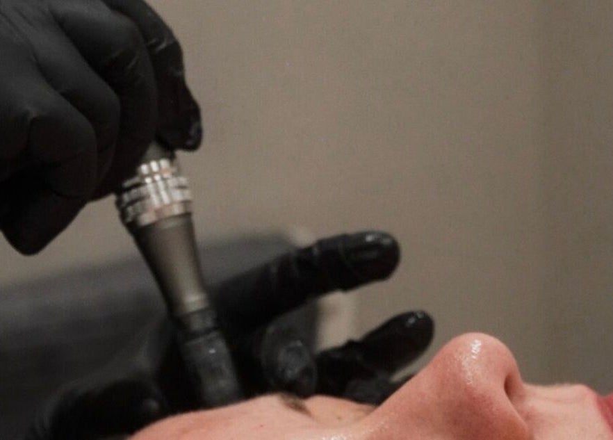 Facial treatment at Cortés & Co Medispa, Usk, Wales, GB, showcasing expert skincare.