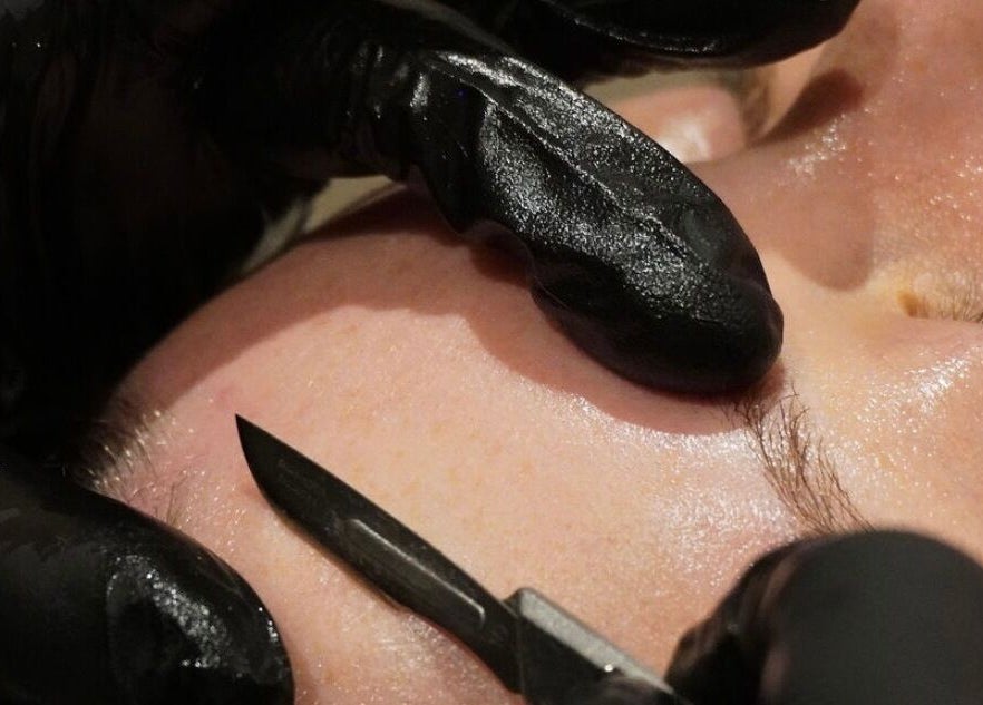 Dermaplaning treatment at Cortés & Co Medispa in Usk, Wales, GB, revealing smooth, glowing skin.