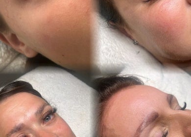 Close-up of smooth facial skin after treatment at Beauty by Bethanie, Kirkby In Ashfield, England, GB.