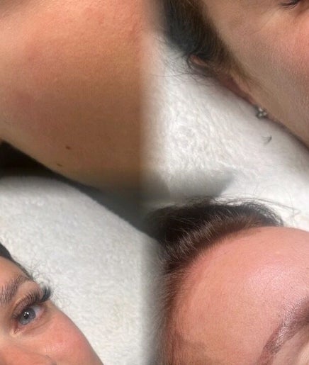 Close-up of smooth facial skin after treatment at Beauty by Bethanie, Kirkby In Ashfield, England, GB.