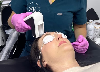 Aesthetician performing laser facial at Skiin Laser Clinic, Peterborough, England, GB.