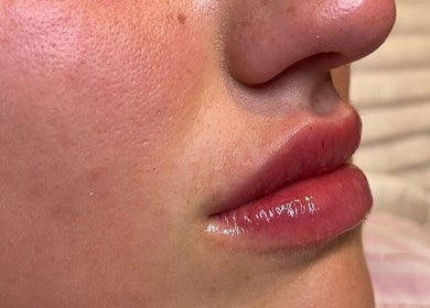 Close-up of glossy lips enhanced at Align Enhancements, Barry, Wales, GB.