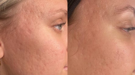 Benhumea Beauty Bar imej 2