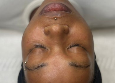 Client enjoying a relaxing facial at AMORE Aesthetics, London, England, GB.