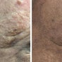 Derma Nurse by Mariana Enfermería Cosmetología y Estética - Oriente 9267, La Florida, Región Metropolitana