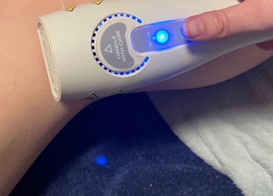Professional laser hair removal at Lumina Beauty & Aesthetics, Whittlesey, England, GB. Smooth skin in progress.