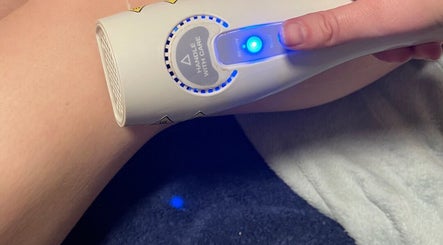 Professional laser hair removal at Lumina Beauty & Aesthetics, Whittlesey, England, GB. Smooth skin in progress.