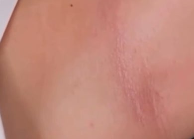 Close-up of smooth skin after treatment at Lumina Beauty Salon, Whittlesey, England, GB.