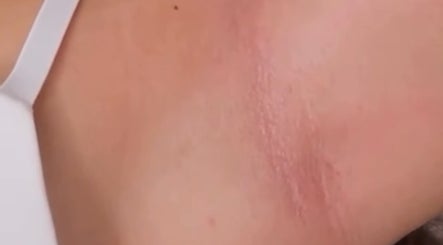 Close-up of smooth skin after treatment at Lumina Beauty Salon, Whittlesey, England, GB.