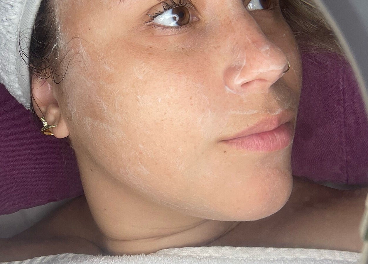 Tratamiento facial en CC Cosmetologa, Montevideo, Departamento De Montevideo, UY.