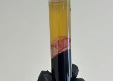 Blood sample preparation at SkinFluence clinic in Stalybridge, England, GB for advanced beauty treatments.