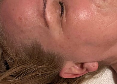 Close-up of serene face at Chin Up Manual Face Therapy, Huddersfield, England, GB.