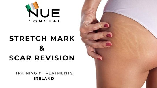 Nue Conceal Ireland 0