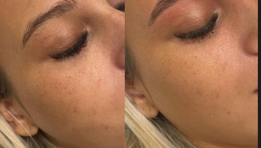 Εικόνα Brows by Chloe 1