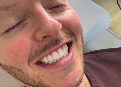 Bright smile after treatment at Blanco Cosmetic Teeth Whitening, Houston, Texas, US.