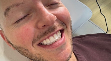 Bright smile after treatment at Blanco Cosmetic Teeth Whitening, Houston, Texas, US.