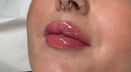 Sculpt Aesthetics Peterborough image 2