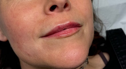 Sculpt Aesthetics Peterborough image 3