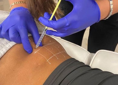 Professional body contouring at Beauty & Aesthetics By Lil, Bradford, England, GB.